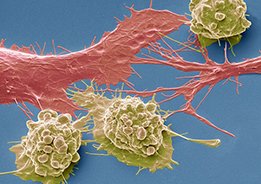 Células do cancro 