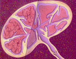 Linfoma