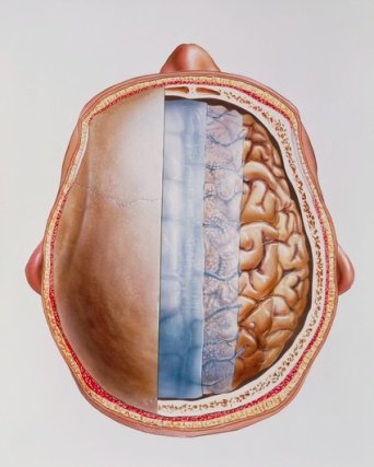 Imagem do cérebro que mostra as meninges (membranas que envolvem o cérebro e a espinal medula).